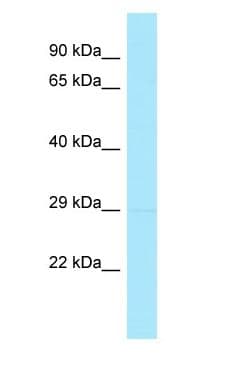 CSAD / CSD Antibody (aa185-234)