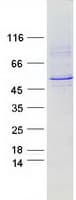 Human CYP2A6 Protein (Recombinant Myc-DDK (Flag))