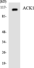 TNK2 / ACK1 Antibody (aa231-280)