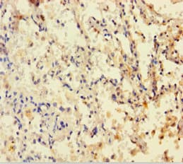 DHFR Antibody (aa2-187)