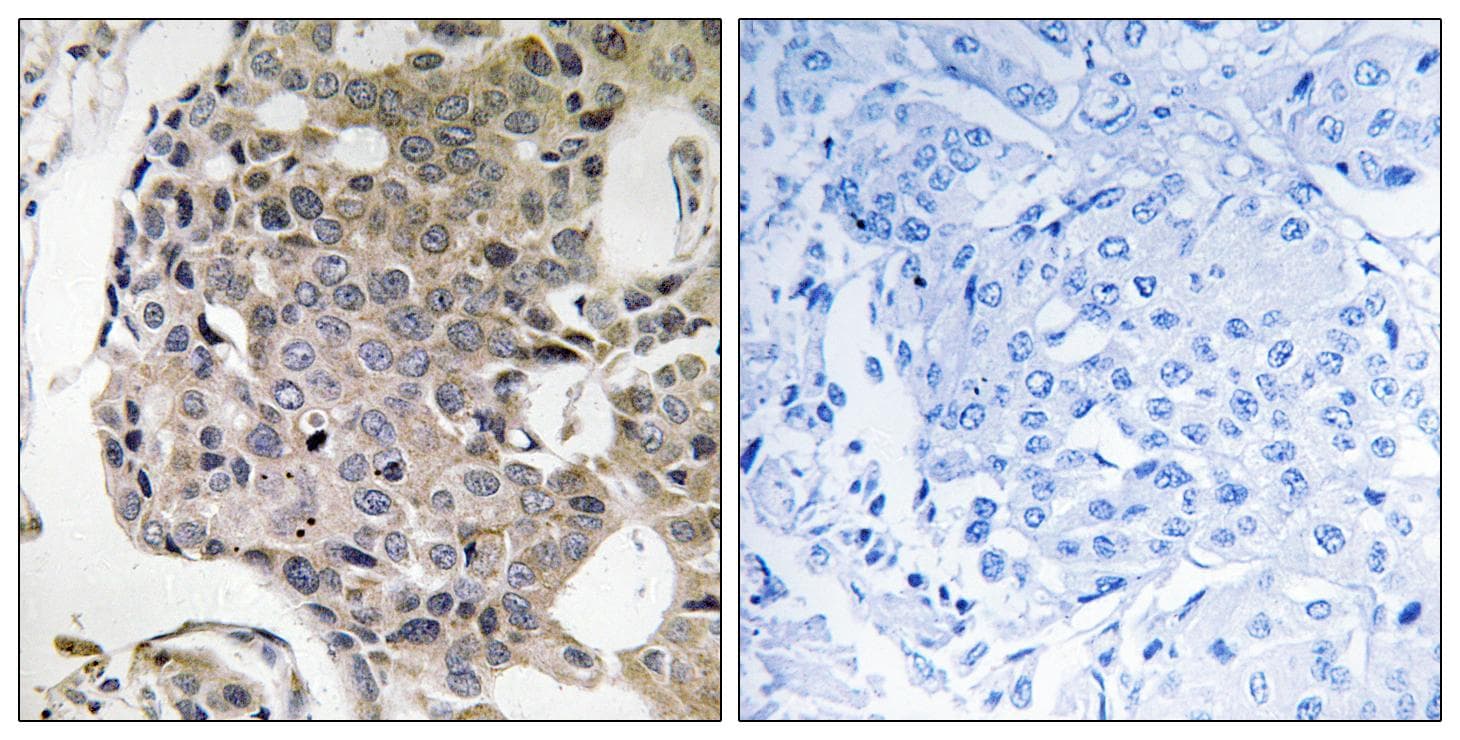 RIMS4 Antibody