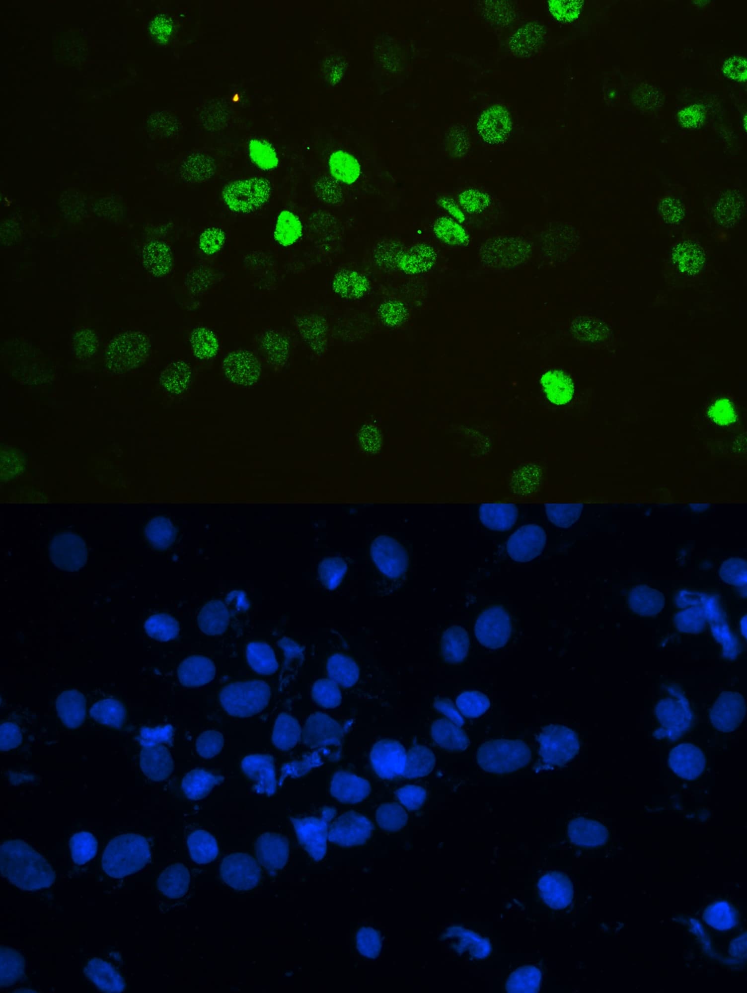 HNRNPF / hnRNP F Antibody