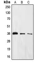 EIF2S1 Antibody (phospho-Ser51)