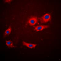 Polyclonal Rabbit anti-Human EIF4EBP1 / 4EBP1 Antibody (N-Terminus, IHC, IF, WB)