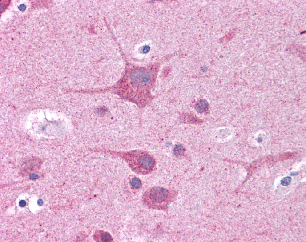 Polyclonal Rabbit anti-Human RORC / ROR Gamma Antibody (aa110-159, IHC, WB)