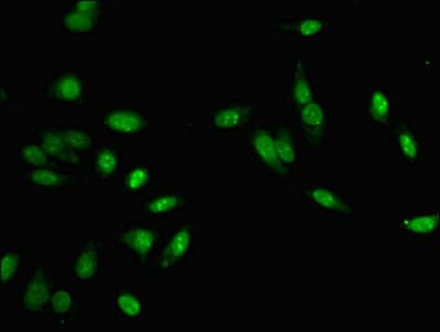 Polyclonal Rabbit anti-Human MLH1 Antibody (IHC, IF, WB)