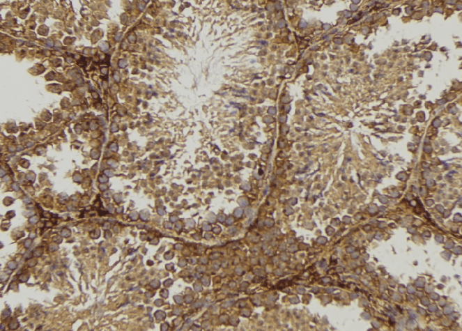 Polyclonal Rabbit anti-Human ODC1 / Ornithine Decarboxylase Antibody (IHC, WB)