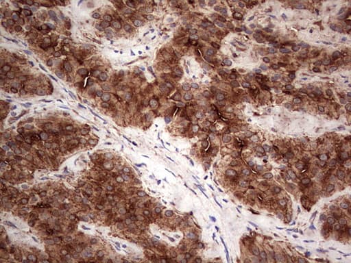 PKM2 Antibody (clone 1G10)