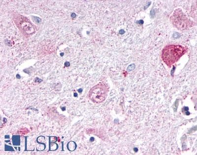 PathPlus™ Polyclonal Rabbit anti-Human NR1D1 Antibody (Internal, IHC)