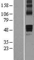 NCEH1 / AADACL1 Protein (Over-Expression Lysate Myc-DDK (Flag))
