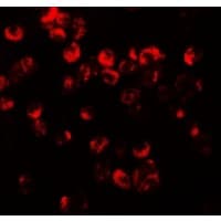 IHC-plus™ Polyclonal Rabbit anti-Human CXCR3 Antibody (IHC, IF, WB)