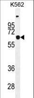 Polyclonal Rabbit anti-Human SLC16A8 Antibody (aa466-493, WB)