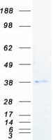 Human PGLYRP3 Protein (Recombinant Myc-DDK (Flag))