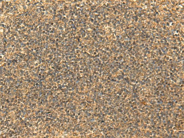 Polyclonal Rabbit anti-Human GLYATL2 Antibody (IHC)