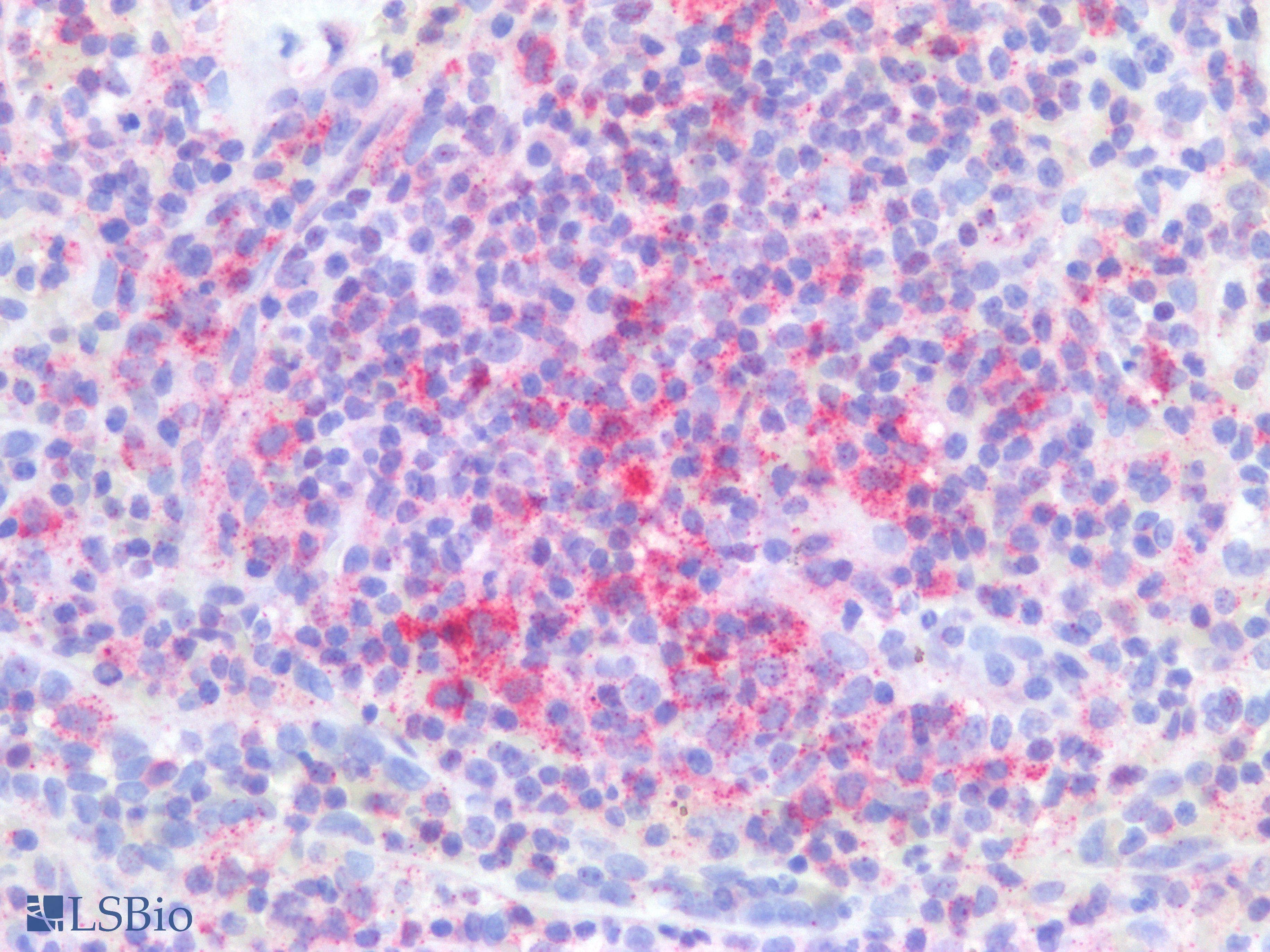 PathPlus™ Polyclonal Rabbit anti-Human PDCD1 / CD279 / PD-1 Antibody (Internal, IHC, WB)