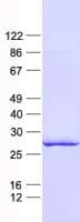 Human ERdj4 / DNAJB9 Protein (Recombinant His, N-Terminal)