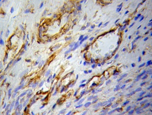 Polyclonal Rabbit anti-Human PPARG / PPAR Gamma Antibody (IHC, WB)