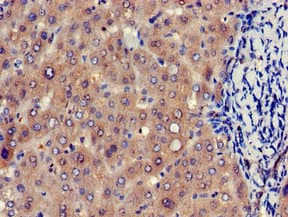 EIF4ENIF1 / 4E-T Antibody