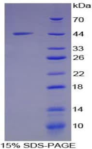 Rat MUC5B Protein (Recombinant His-GST)