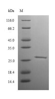 Rat RB1 / Retinoblastoma / RB Protein (Recombinant 6His, N-terminus)