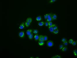IFIT1 / ISG56 Antibody (clone OTI3G8)