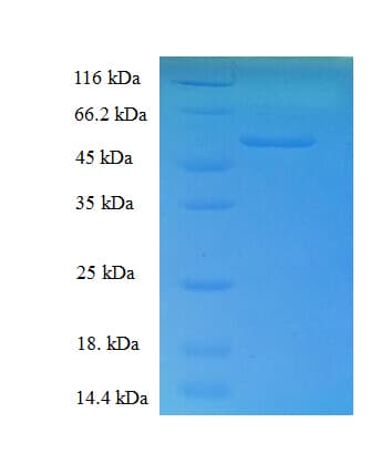 Human RDH11 Protein (Recombinant His-SUMO)