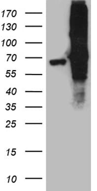 Monoclonal Mouse anti-Human FUBP3 Antibody (clone OTI9B2, aa2-572, WB)