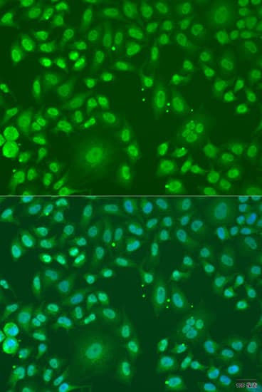 Polyclonal Rabbit anti-Human ARL6 Antibody (IF, WB)