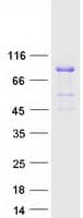 Human RHOT2 Protein (Recombinant Myc-DDK (Flag))
