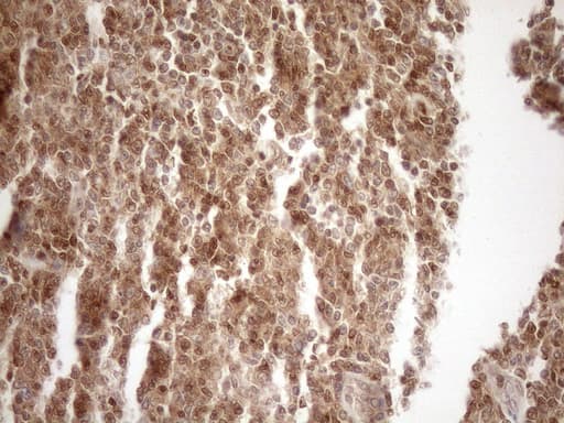 MGMT Antibody (clone OTI10H9)