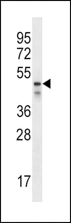 Polyclonal Rabbit anti-Human PDZK1 Antibody (aa196-224, IHC, WB)