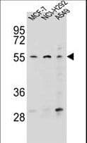 Polyclonal Rabbit anti-Human HPF9 / ZNF117 Antibody (aa13-41, WB)