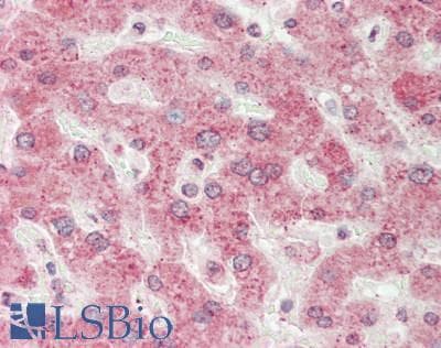 IHC-plus™ Polyclonal Rabbit anti-Human Cytochrome P450 2R1 / CYP2R1 Antibody (aa230-279, IHC, WB)