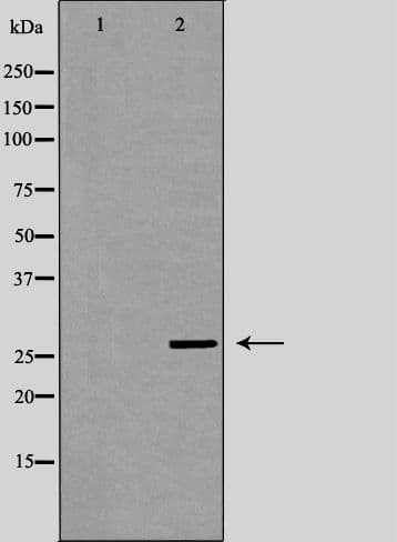 CDKN1B / p27 Kip1 Antibody
