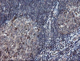 DPH2 Antibody (clone OTI4E7)