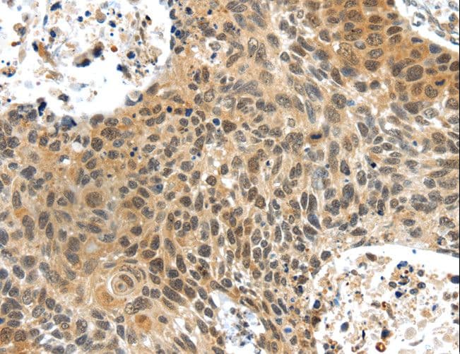 Polyclonal Rabbit anti-Human PLIN3 / M6PRBP1 / TIP47 Antibody (IHC)