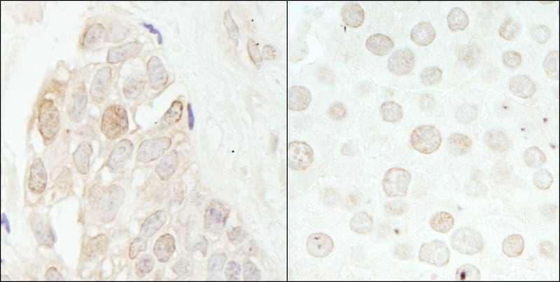 CDK2 Antibody (aa248-298)