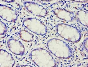 ABCF2 Antibody (aa1-250)