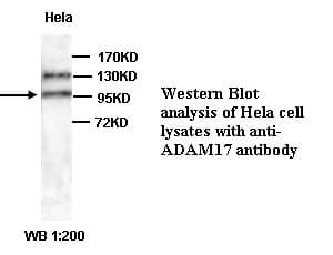 ADAM17 / TACE Antibody (C-Terminus)