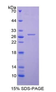Human TNNI3 / Cardiac Troponin I Protein (Recombinant His)