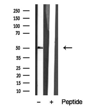 Polyclonal Rabbit anti-Human RARA / RAR Alpha Antibody (WB)