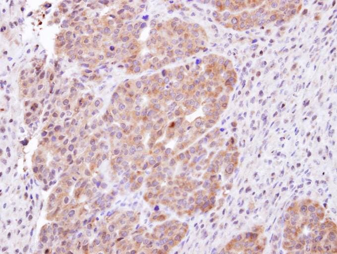 Polyclonal Rabbit anti-Human Vps60 / CHMP5 Antibody (aa1-202, IHC, WB)