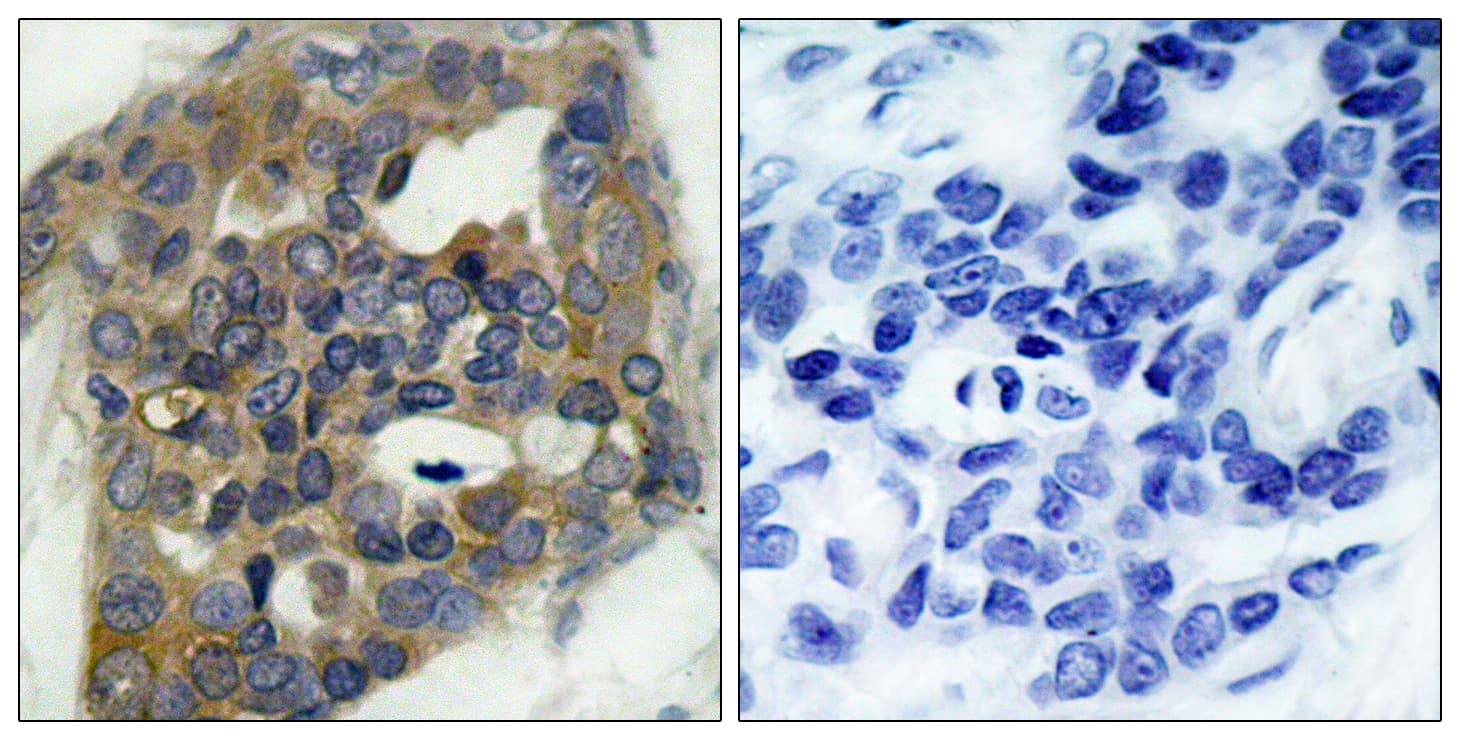 Polyclonal Rabbit anti-Human MAP3K5 / ASK1 Antibody (phospho-Ser966, IHC, WB)