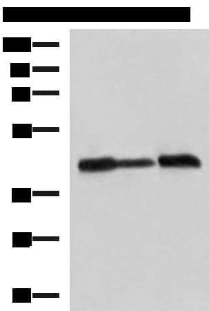 PDHA1 / PDH E1 Alpha Antibody