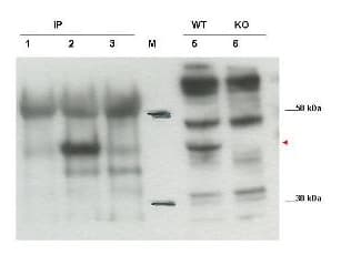 CYTIP Antibody