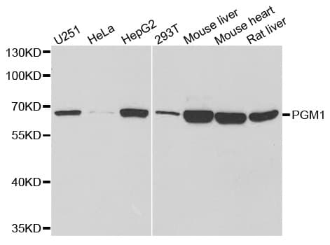 PGM1 / Phosphoglucomutase 1 Antibody