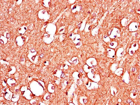 IGHMBP2 Antibody
