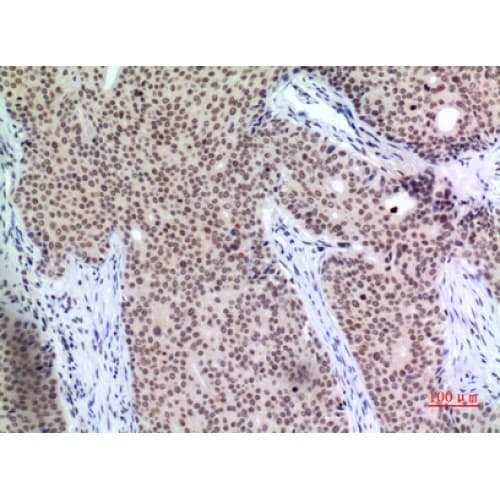 CDKN1C / p57 Kip2 Antibody