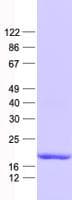 Human DUSP22 / JSP 1 Protein (Recombinant His, N-Terminal)