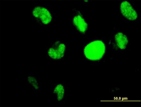 HIC1 Antibody (clone 4E11)